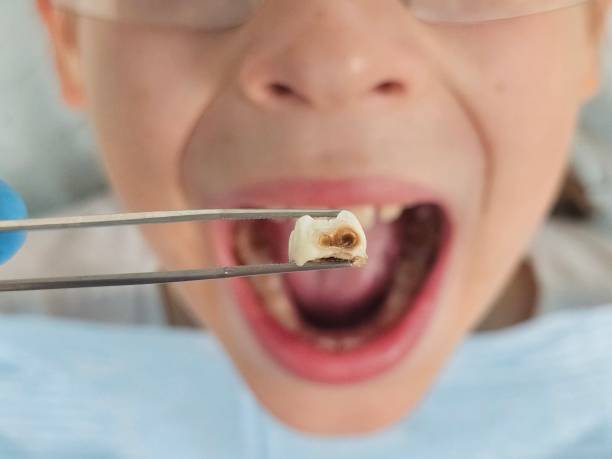 Best Dentist Open on Weekends  in Blue Rapids, KS